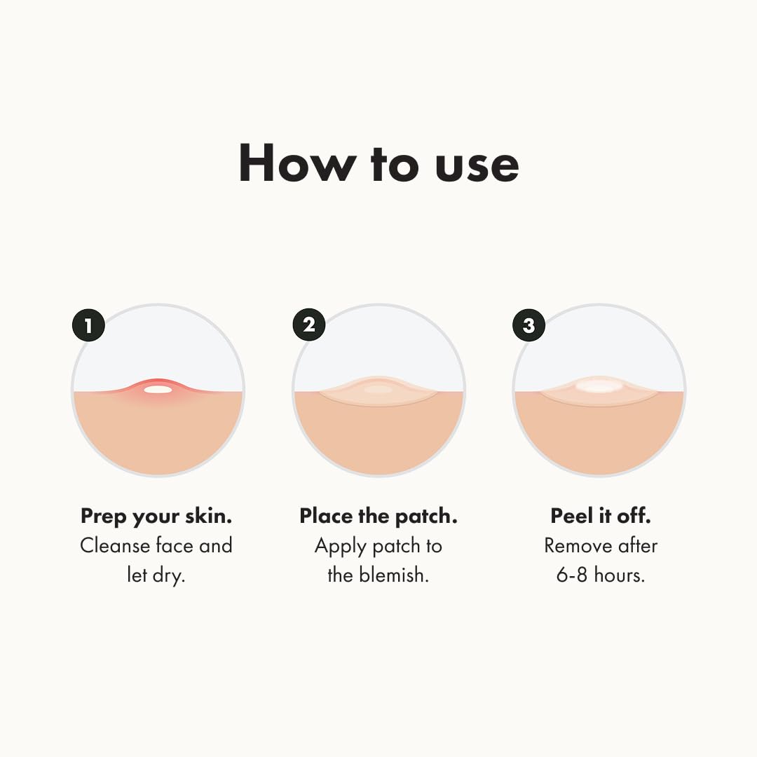 Hero Cosmetics Mighty Patch Original - The Ultimate Hydrocolloid Acne Pimple Patch for Rapid Zit and Whitehead Reduction (36 Count)