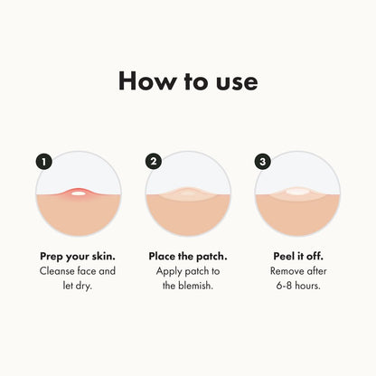 Hero Cosmetics Mighty Patch Original - The Ultimate Hydrocolloid Acne Pimple Patch for Rapid Zit and Whitehead Reduction (36 Count)