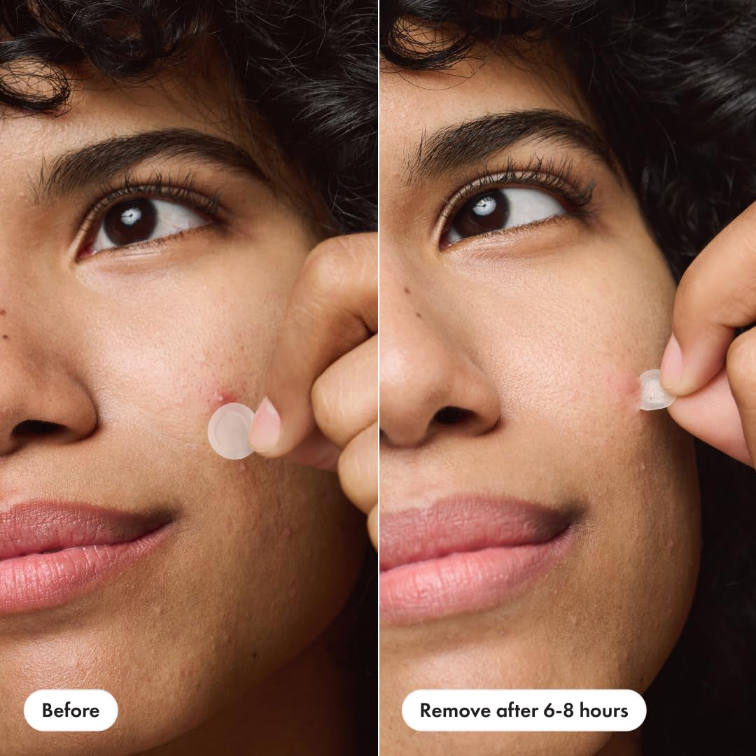 ™ Invisible+ Patch – the Barely-There Daytime Hydrocolloid Acne Pimple Patch for Covering Zits and Blemishes, Tapered Edges Designed to Blend into Skin (72Ct)